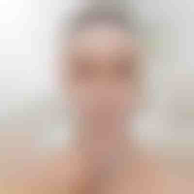 Gesichtsformendes Lifting-Band | KIMLIFT